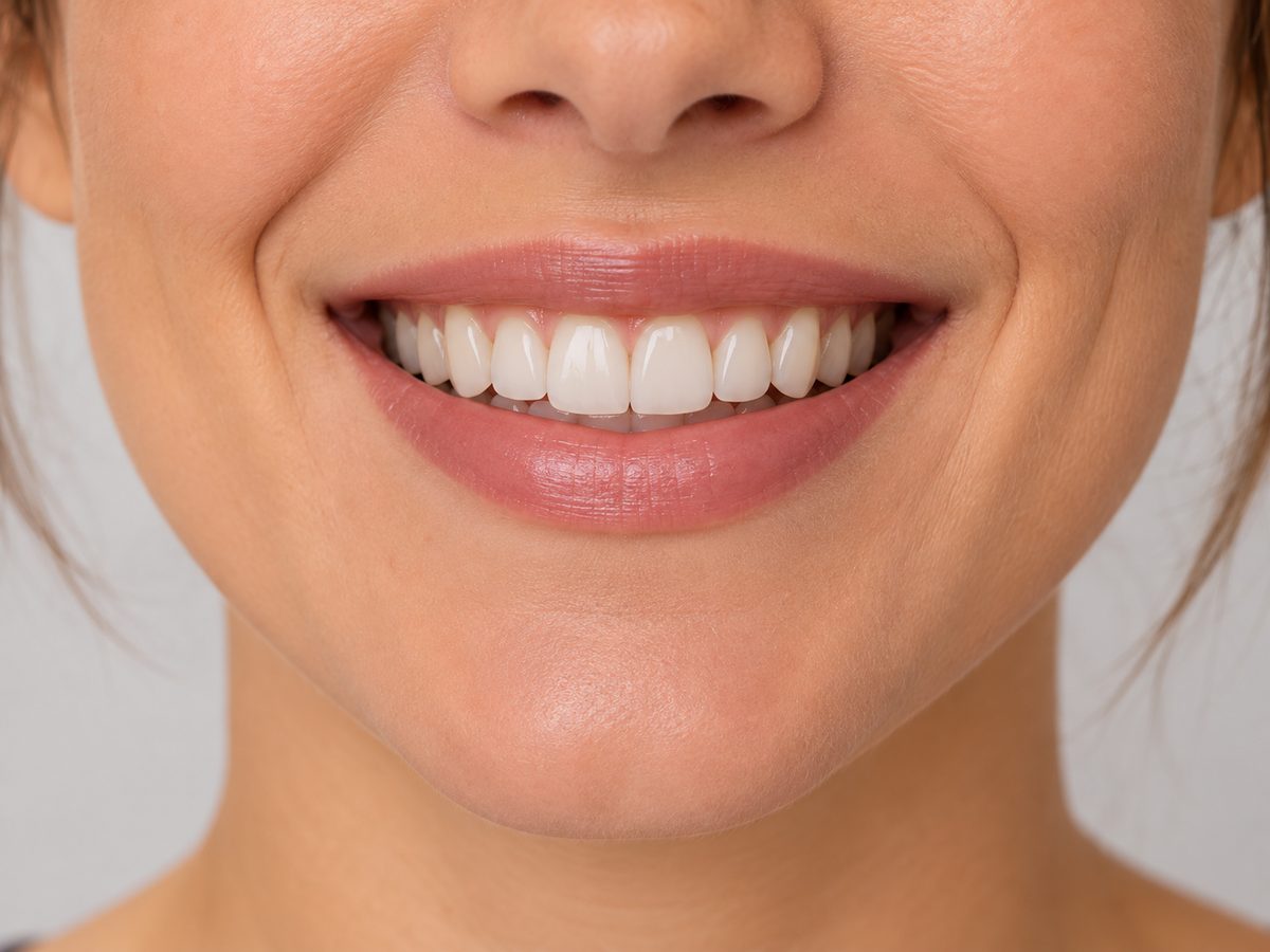 Sorriso depois do tratamento